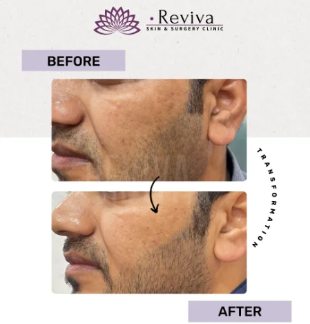 Before and after result 8